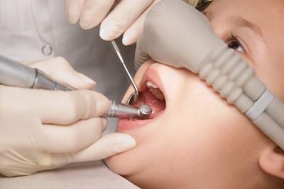 young child getting sedation in dental chair