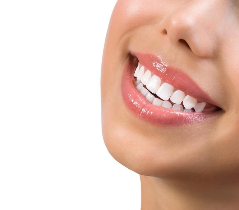 close up of woman's smile after invisalign in barrie