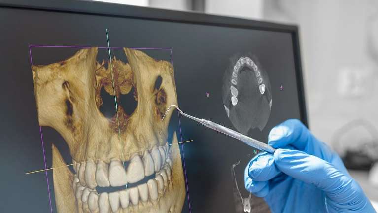 dentist looking at jaw from ct scanner in a barrie dental office